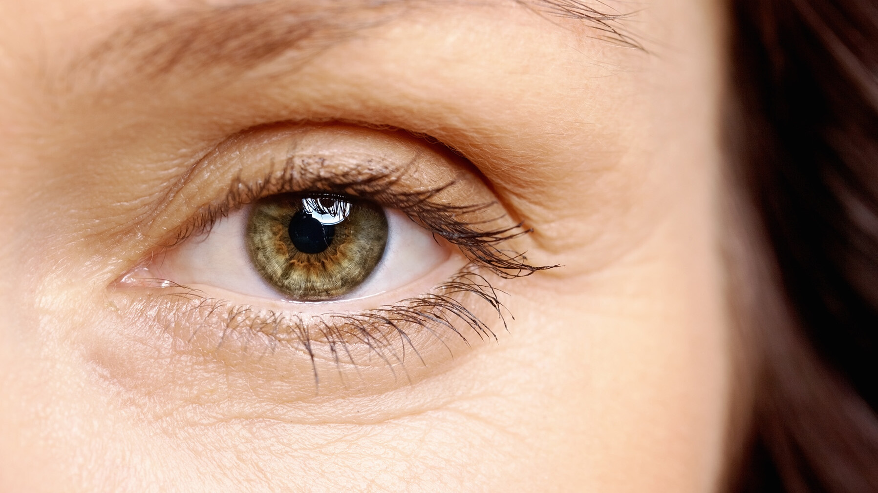 Es gibt verschiedene Therapien bei Netzhauterkrankung Nahaufnahme vom ein Auge einer Frau