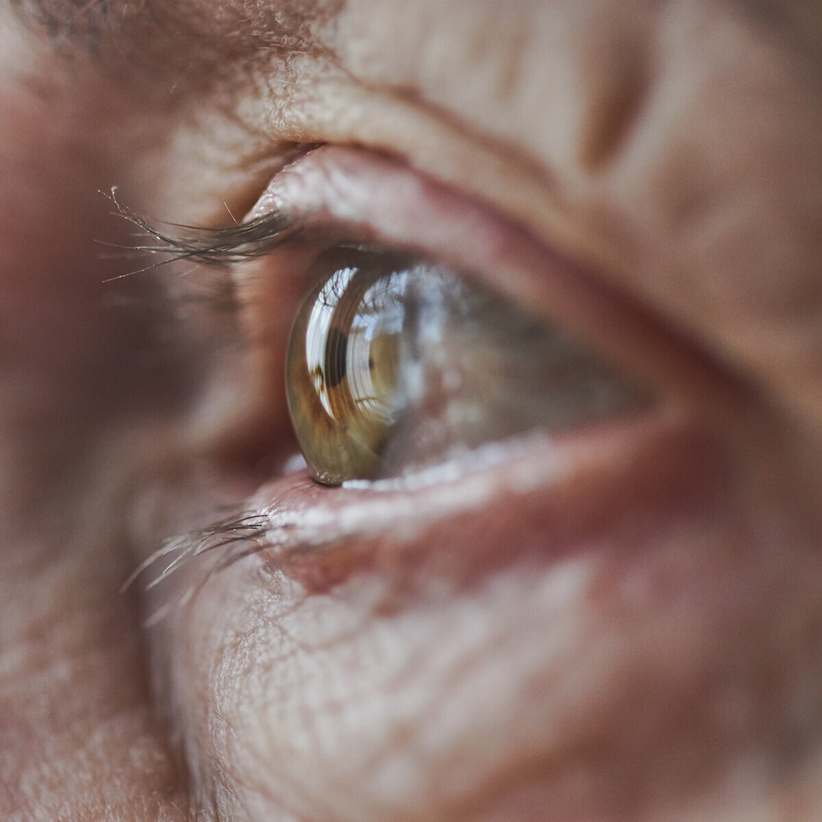 Netzhauterkrankungen können gut behandelt werden Nahaufnahme menschliches Auge im Profil