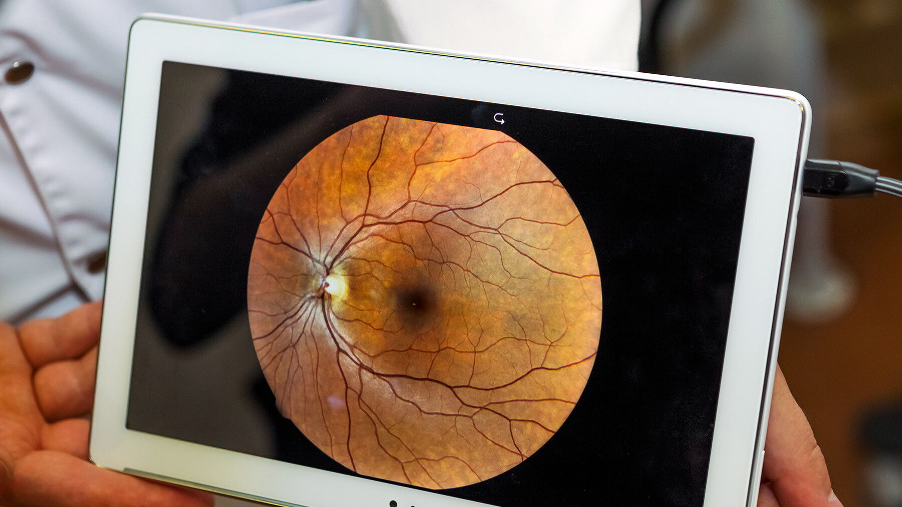 Veränderungen auf der Netzhaut können sichtbar gemacht werden Nahaufnahme eines Tablets, das Blutgefäße auf der Netzhaut zeigt.